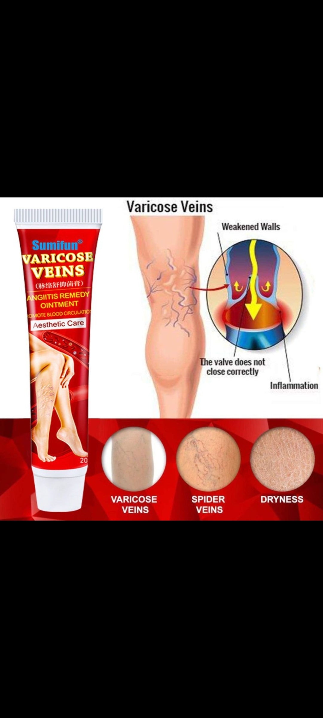POMADA CREMA PARA LAS VARICES